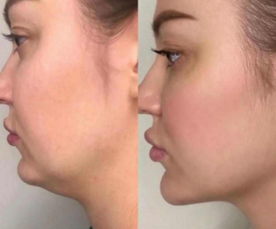 Masajeador Facial y de Cuello para Reafirmar tu piel