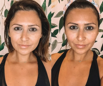 Masajeador Facial y de Cuello para Reafirmar tu piel