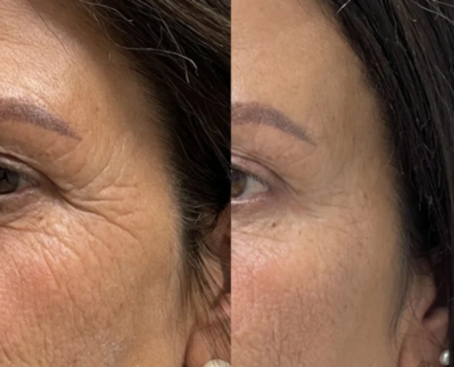 Masajeador Facial y de Cuello para Reafirmar tu piel