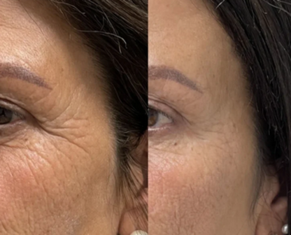 Masajeador Facial y de Cuello para Reafirmar tu piel