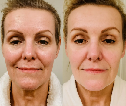 Masajeador Facial y de Cuello para Reafirmar tu piel