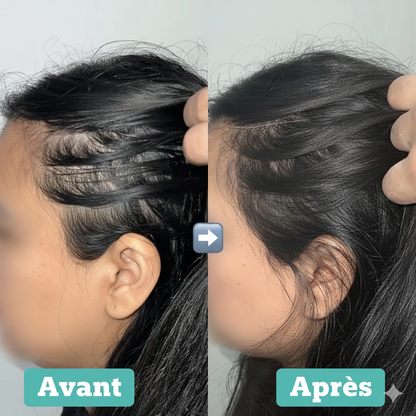 Peine Masajeador Relajante de Cuero Cabelludo